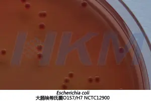 大肠埃希氏菌 O157:H7 NCTC12900 生物图册 大肠埃希氏菌 O157:H7 NCTC12900 生物图册