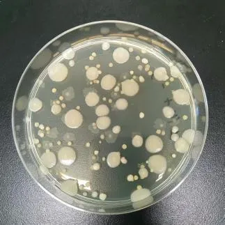蜡样在有氧和厌氧的两种状态下，生长速度差异很大，表面菌落远远大于内部的菌落