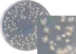 置厌氧条件下培养 48~72 小时,菌落直径2-6mm,中部凸起,白色到淡黄色,具有灰色,假根状、半透明,表面无光泽 置厌氧条件下培养 48~72 小时,菌落直径2-6mm,中部凸起,白色到淡黄色,具有灰色,假根状、半透明,表面无光泽