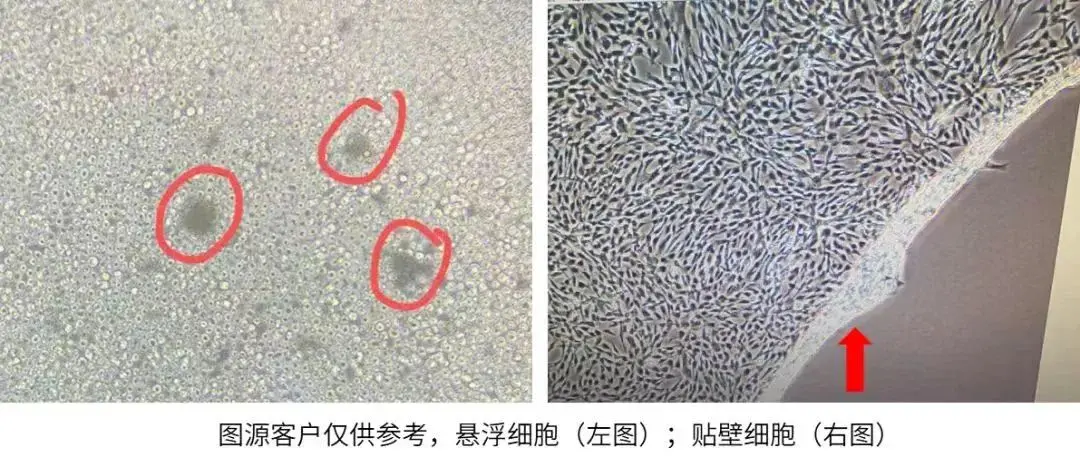 悬浮细胞与贴壁细胞