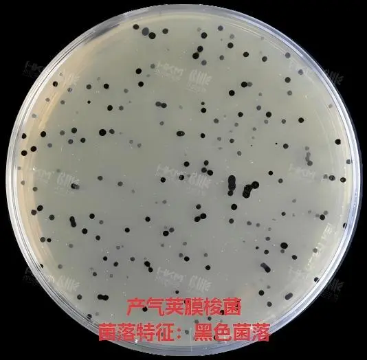 产气荚膜梭菌接种于亚硫酸盐-多粘菌素-磺胺嘧啶(SPS)琼脂培养基35~37℃厌氧培养24h,其菌落特征为黑色菌落。 产气荚膜梭菌接种于亚硫酸盐-多粘菌素-磺胺嘧啶(SPS)琼脂培养基35~37℃厌氧培养24h,其菌落特征为黑色菌落。