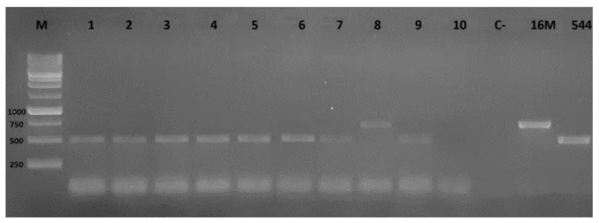 生牛乳样本PCR扩增产物1%琼脂糖凝胶电泳(AMOS PCR显示731bp条带) 生牛乳样本PCR扩增产物1%琼脂糖凝胶电泳(AMOS PCR显示731bp条带)